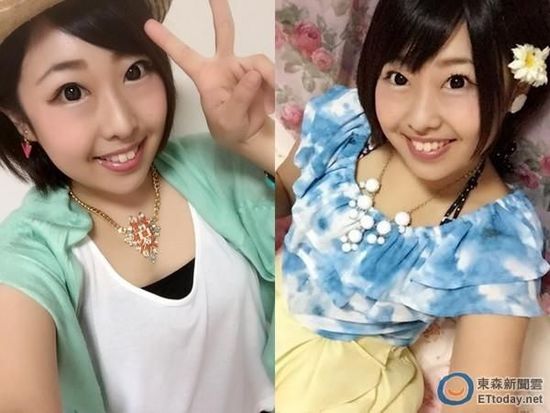 夏目亚季在17岁就罹患罕见疾病“自体免疫溶血性贫血”